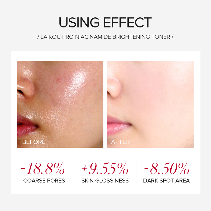 LAIKOU PRO Niacinamide 4Pcs Br - Skincare Niacinamide 评论和价格