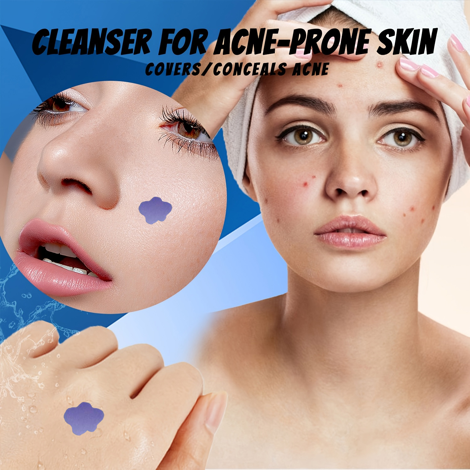 Microneedle Acne Pimple Patch  - Skincare Acne 评论和价格