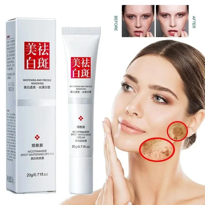 Fades Freckle Dark Spots Face  - Skincare Niacinamide 评论和价格