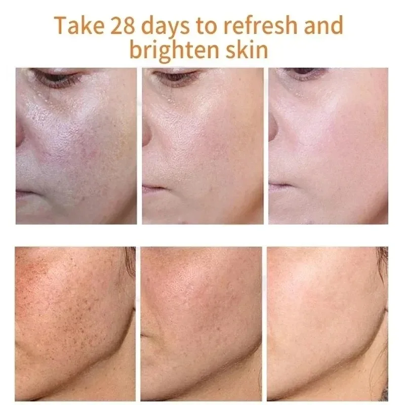 Fades Freckle Dark Spots Face  - Skincare Niacinamide 评论和价格