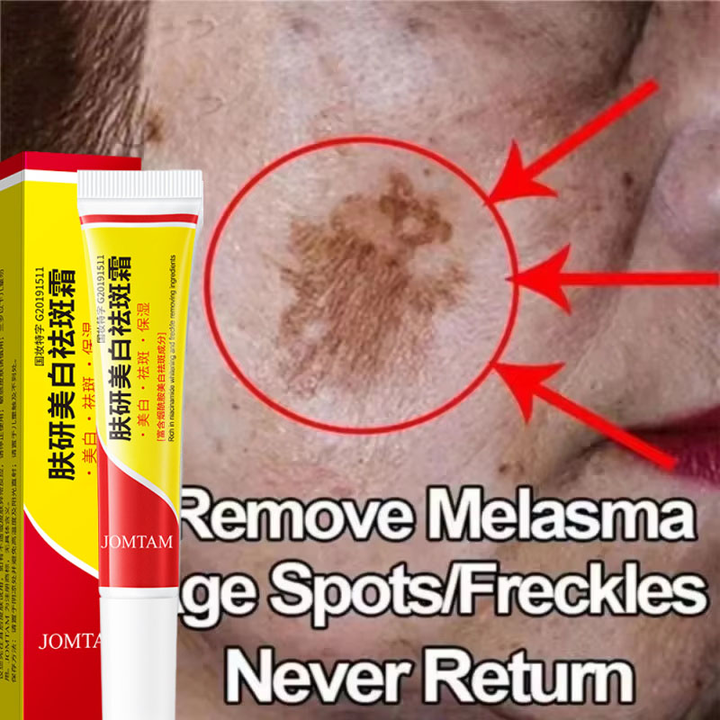 Whitening Freckle Cream Face B - Skincare Niacinamide 评论和价格