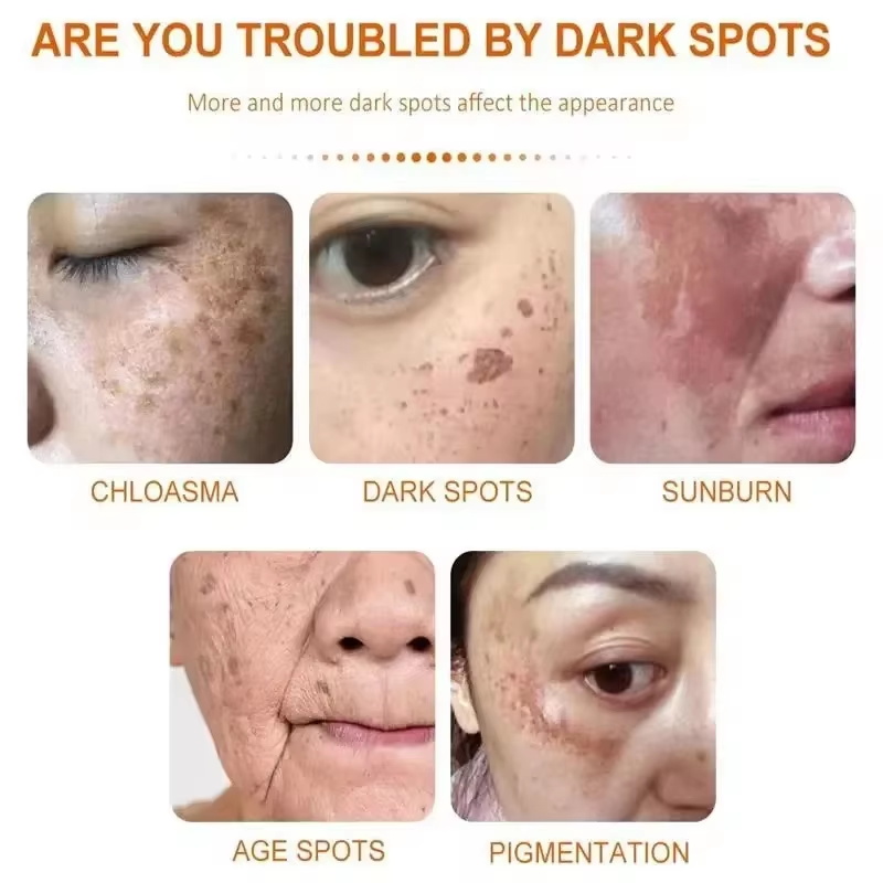 Whitening Freckle Cream Face B - Skincare Niacinamide 评论和价格