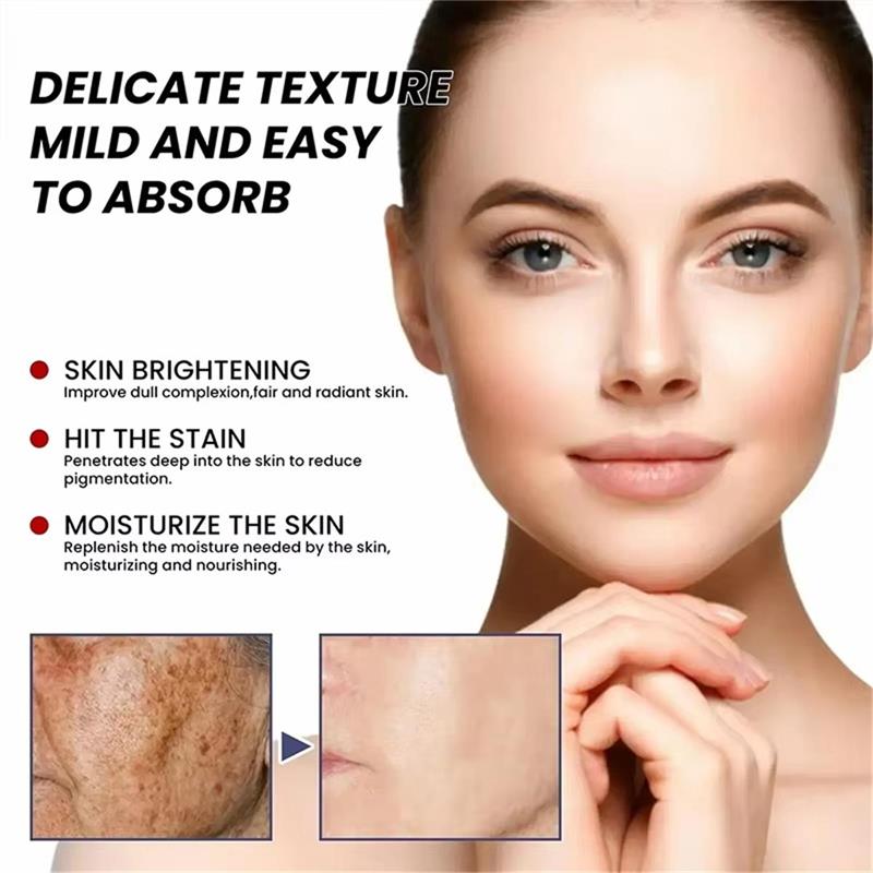 Whitening Freckle Cream Face B - Skincare Niacinamide 评论和价格
