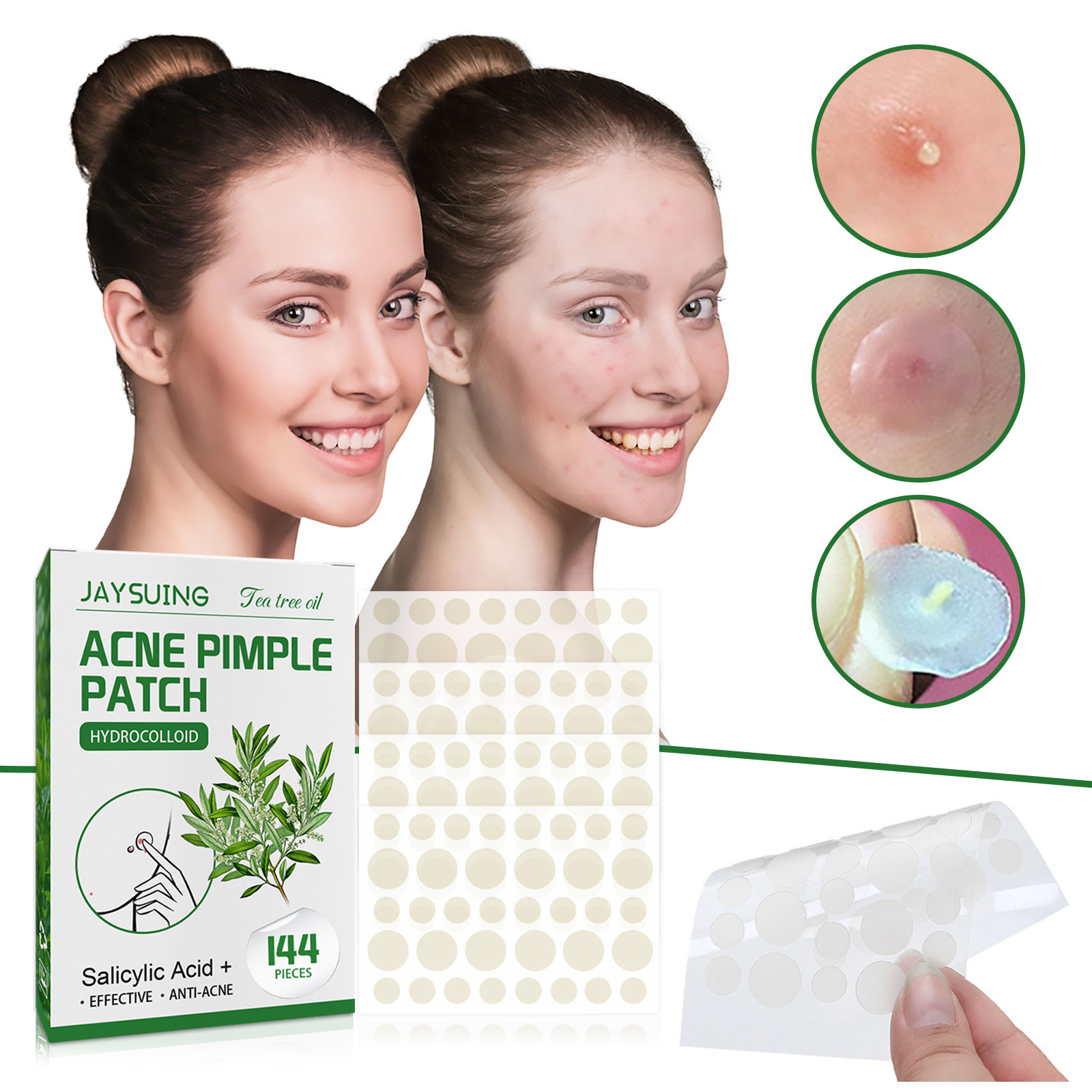 Hydrocolloid Acne Patches - Ab - Hydrocolloid Acne Patch 评论和价格